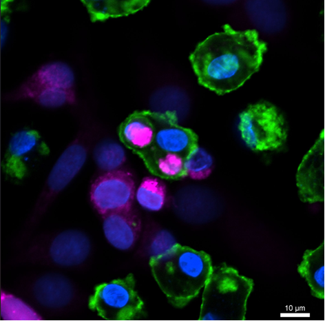 AB-CAR: Engineered macrophages to deliver therapeutics locally in diseased lesions