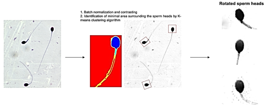 Automatic Identification of Human Spermatozoa with Zona Pellucida Binding Capability in Clinical Assisted Reproduction using Deep Learning