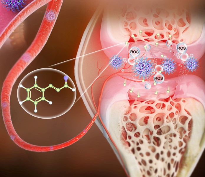Cinnamaldehyde-based nanomedicine platform for rheumatoid arthritis treatment